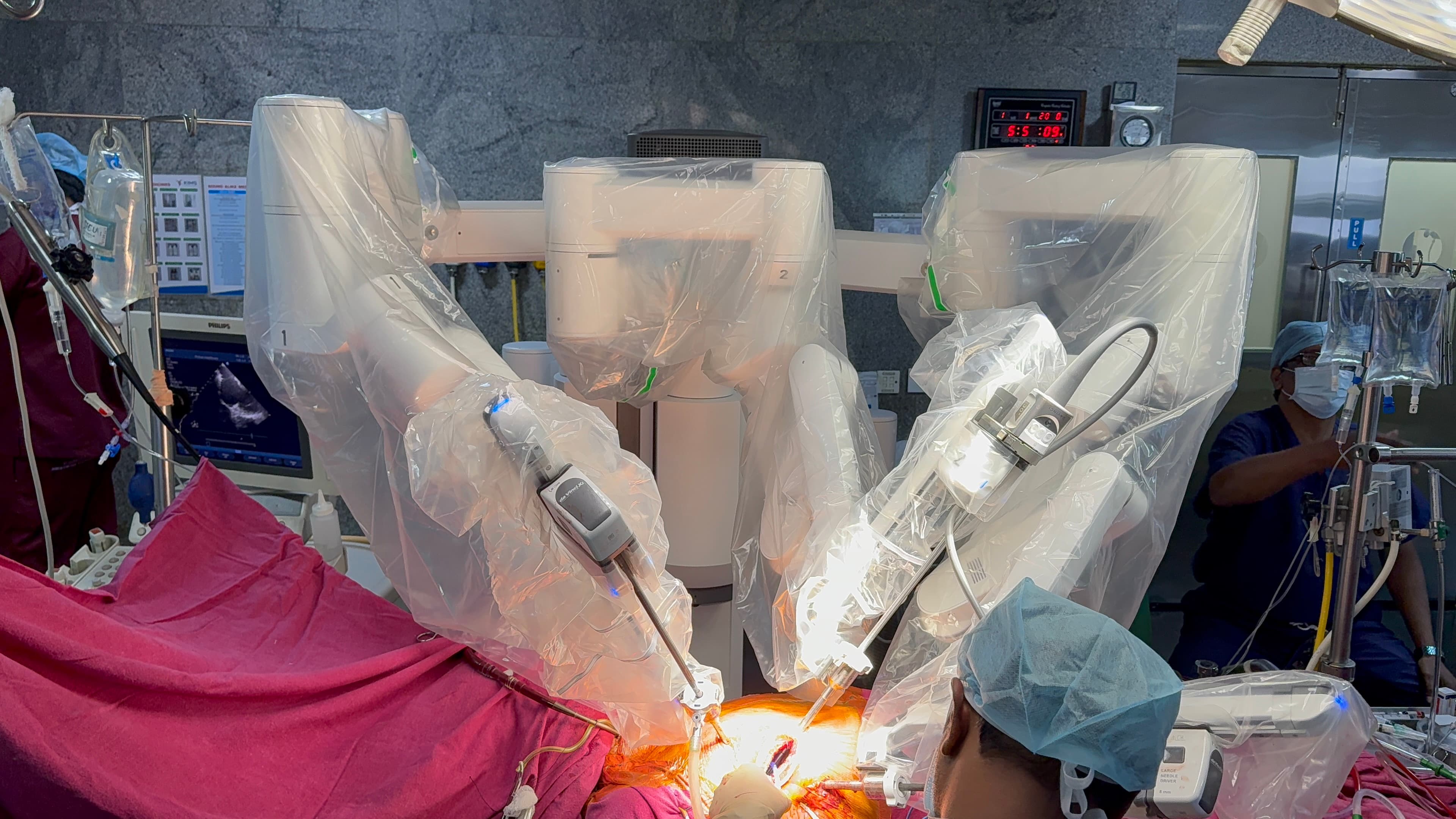 Dr. Nisarga — performing robotic and minimally invasive cardiac surgery